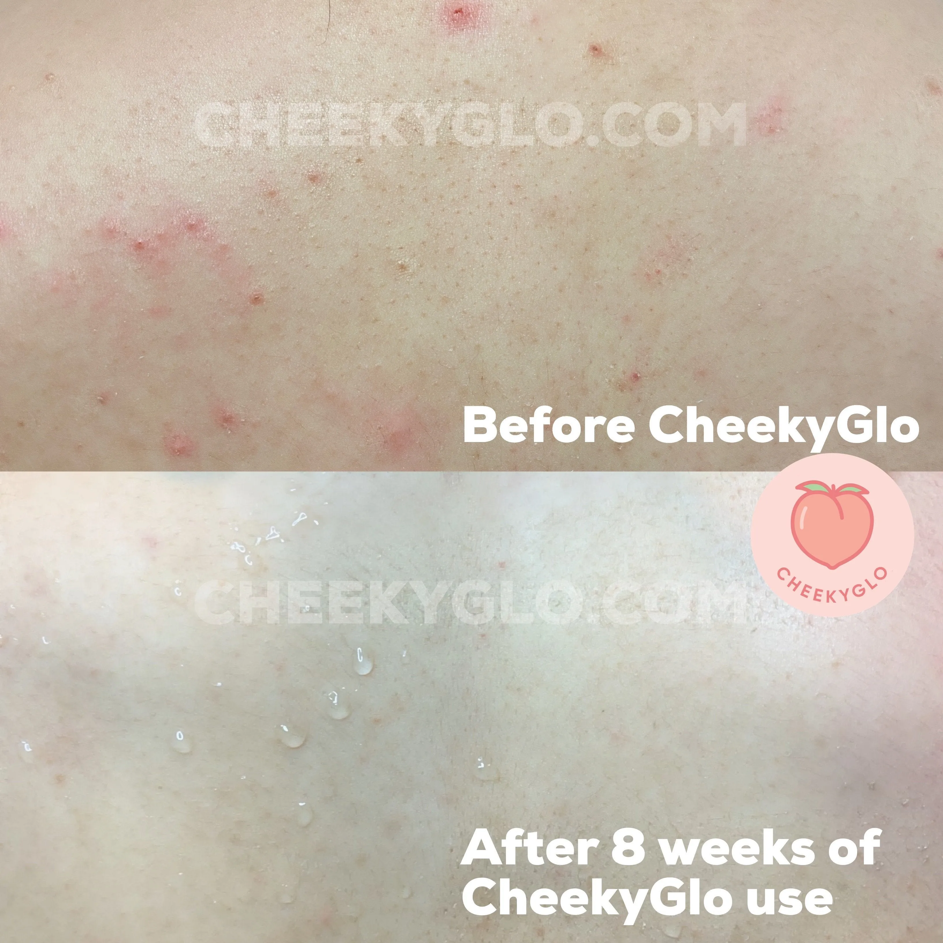 CheekyGlo Exfoliating Glove